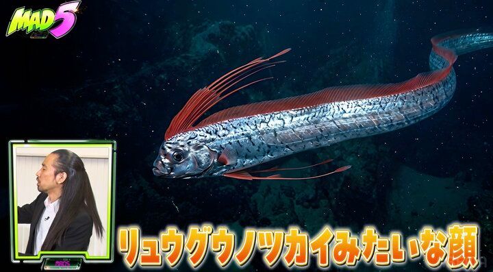 【写真・画像】「リュウグウノツカイみたいな顔」の人気芸人、全身包帯姿に…「やば」くっきー！ら驚き 2枚目