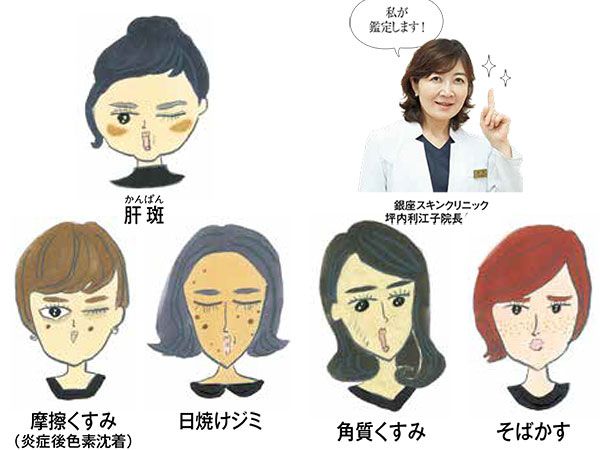 シミ＆くすみのオススメ予防法