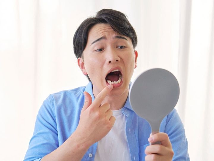 【歯科医が回答】「まだ若いから大丈夫」「腫れが引いたから治った」は危険な思い込みです。40代でも歯を失い、入れ歯になるケースは珍しくありません。自覚症状が落ち着いている間にも静かに進行する歯周病に、注意が必要です。（※画像：Shutterstock.com）