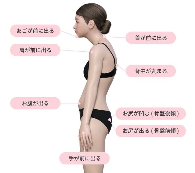 猫背による影響