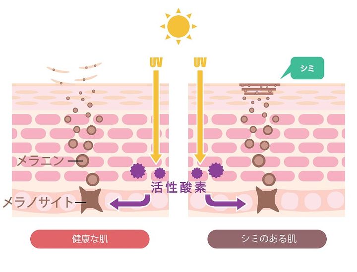 シミができる図説 イラスト