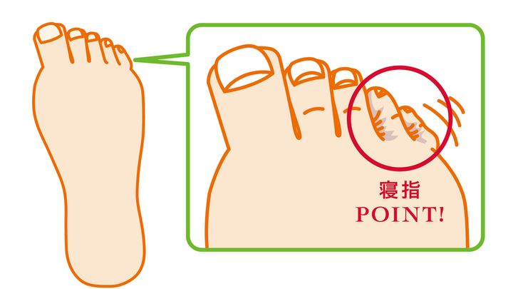 足の不調のカギは、小指にあった!? 寝指が目覚める、ほぐしストレッチ