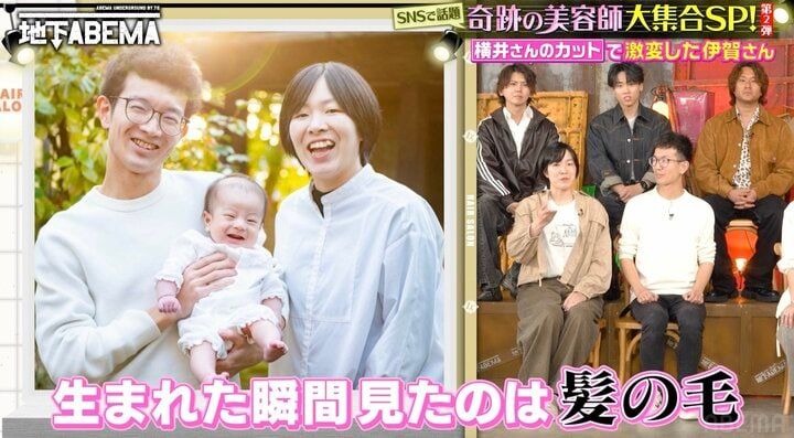 【写真・画像】何度カットしても剛毛ビフォーに戻る男、幼少期の写真に驚きの声「突然変異！」 2枚目