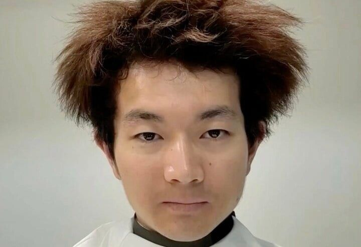 【写真・画像】何度カットしても剛毛ビフォーに戻る男、幼少期の写真に驚きの声「突然変異！」 1枚目