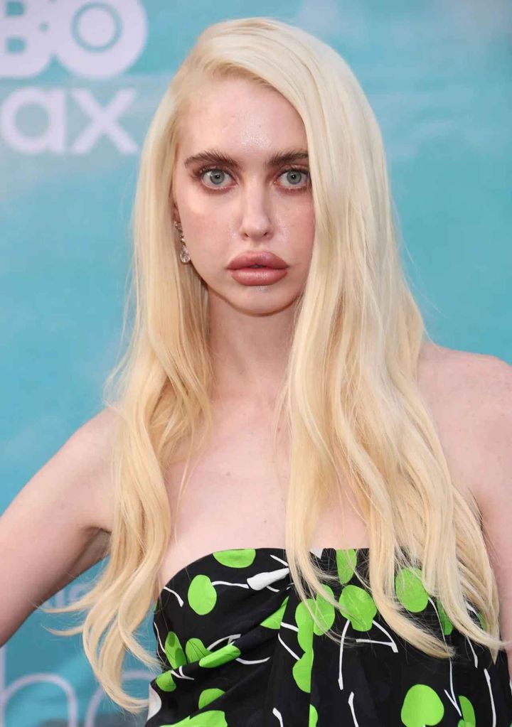 画像: 人気女優、唇にヒアルロン酸を入れすぎたと告白「顔が嫌いだった」