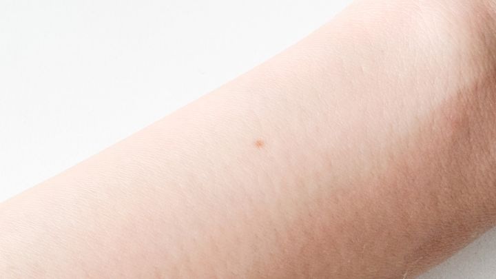 100均でほくろ隠しテープは買える？【ダイソー・セリア】を調査！
