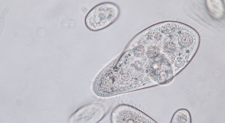 繊毛虫は何を取り込んでしまったのか？