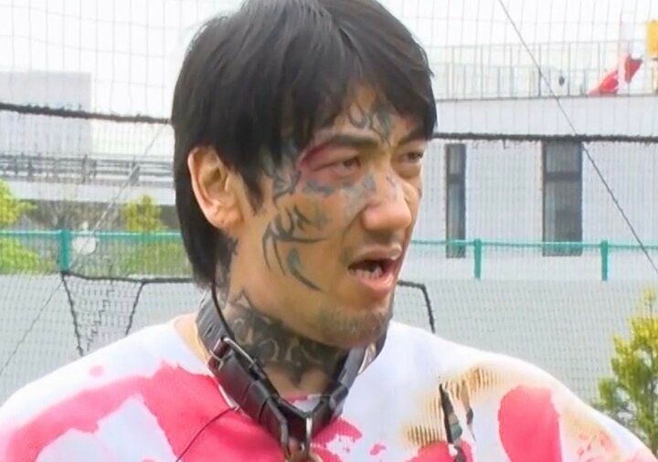【写真・画像】「指がない」瓜田純士の手に芸人ら驚愕「力入らない」「ビックリしたわ」 1枚目