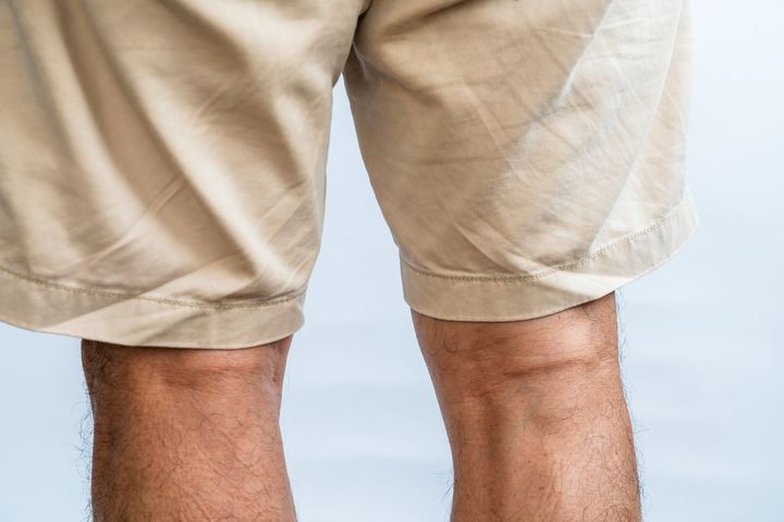 クールビズとしてハーフパンツを導入する会社は、どのようなルールを作るとよい？（画像はイメージ）