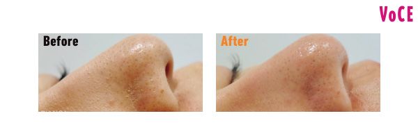Before After