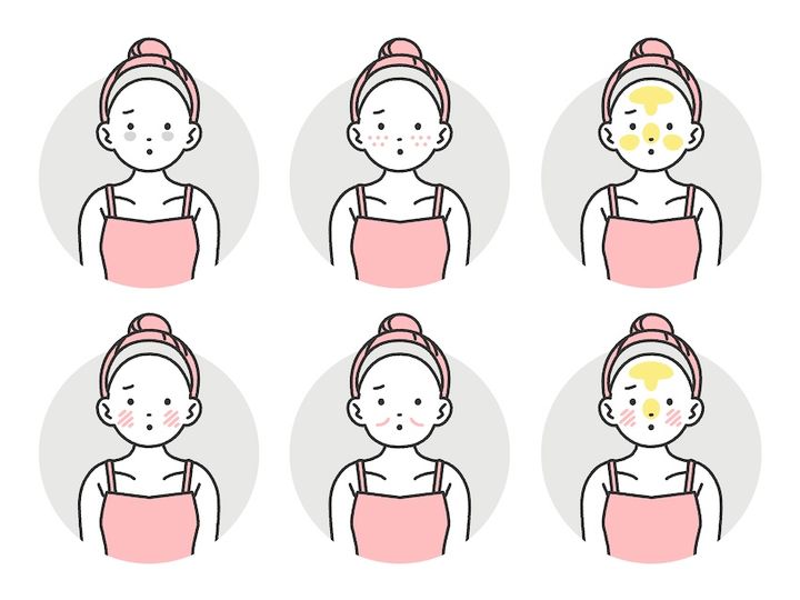 異なる肌トラブルや肌タイプ 6つの差異 イラスト
