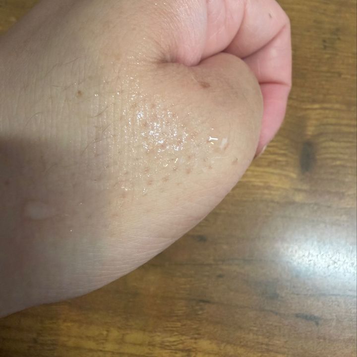 【ドンキ】話題の「擦るだけ除毛パッド」は本当に痛くない？失敗しない使い方のコツも紹介！