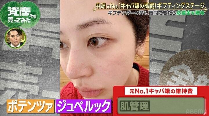【写真・画像】整形に500万円超かけ中洲元No.1に 28歳キャバ嬢がビフォーアフター公開「見た目を気にするように…」 2枚目