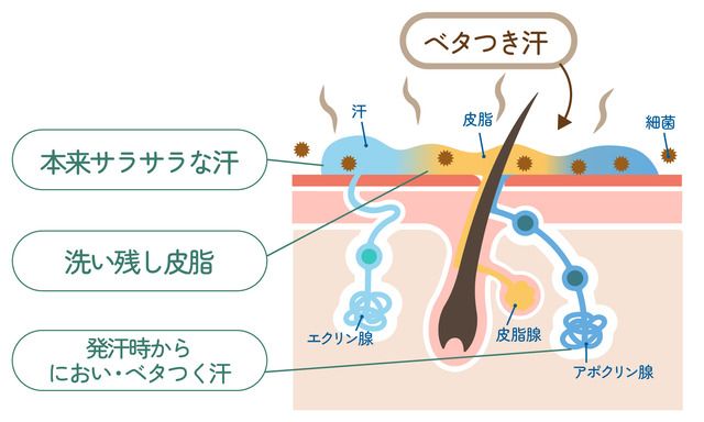 「洗い残し皮脂」とお風呂上がりの「サラサラ汗」が合体し、ベタつき汗に