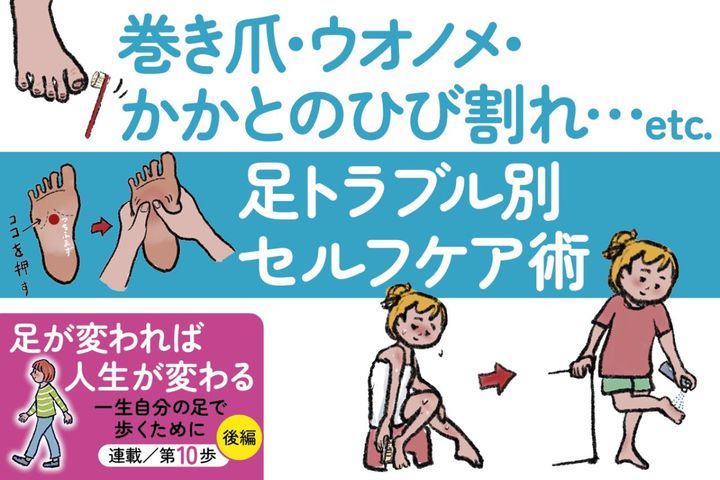 巻き爪・ウオノメ・かかとのひび割れ……足トラブル別セルフケア術【足連載／第10歩・後編】