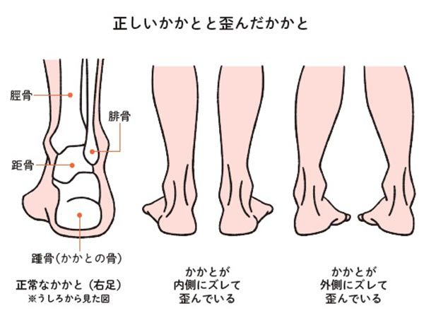 【セルフチェック1】転びやすい人は要注意！くるぶしの位置は左右平行？