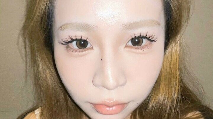 【写真・画像】「顔はやってないところがない」400万円の整形で激変した美女、ビフォーアフターに絶賛の声「可愛い！」 1枚目