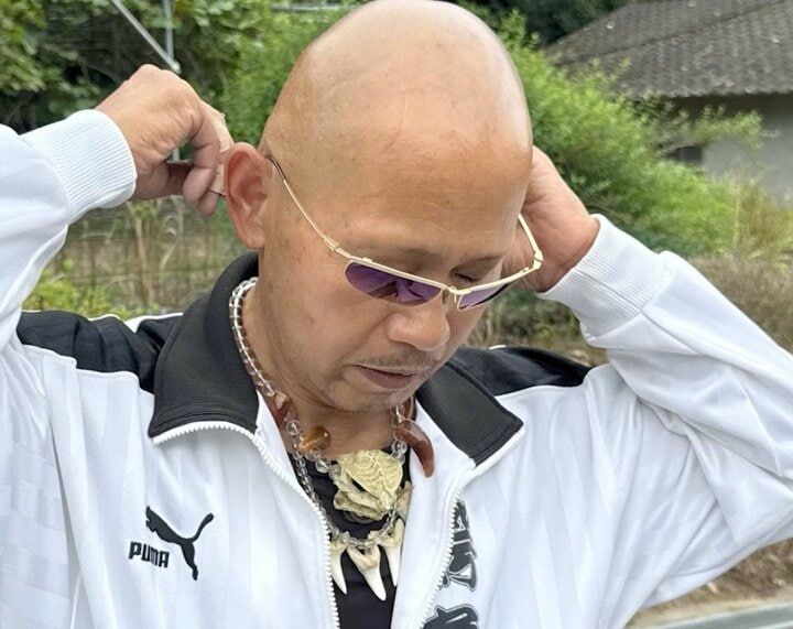 腕に金属探知機を当てると音が…「マイクロチップが埋め込まれてる」