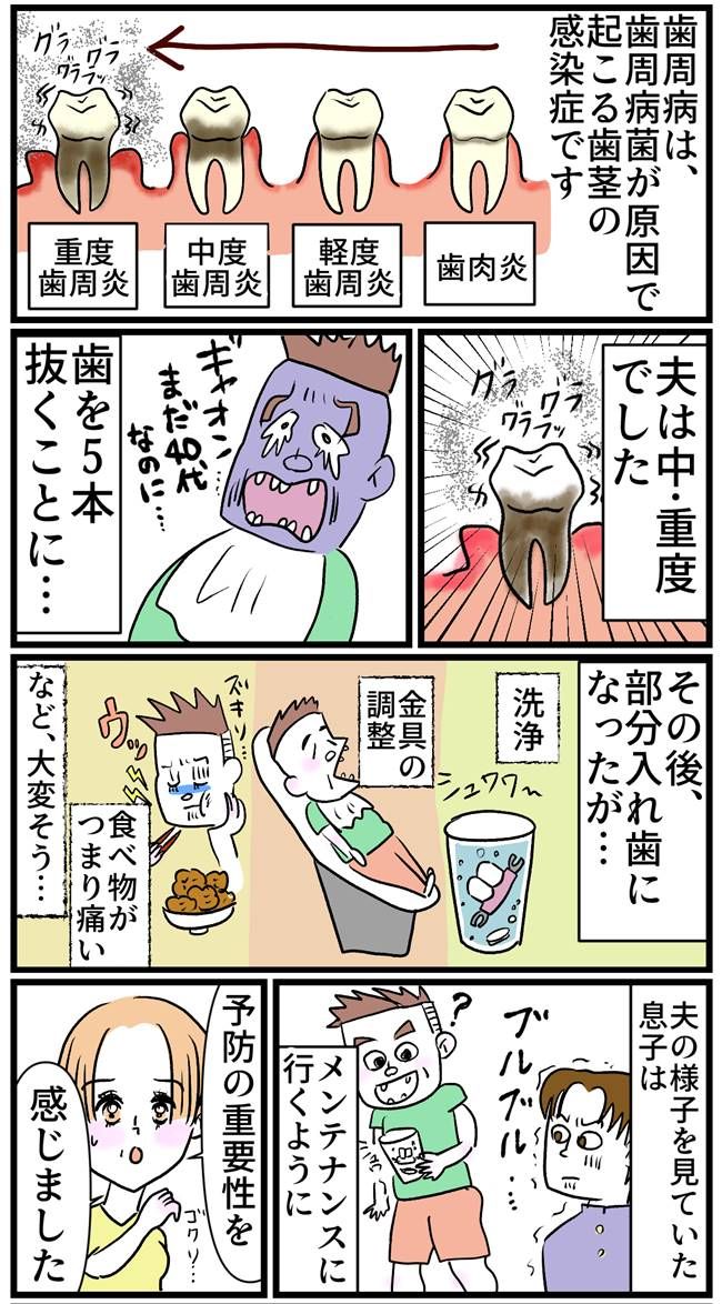 虫歯がなかったことが自慢の夫に突然降りかかった悲劇
