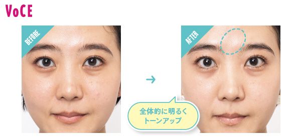 BEFORE→AFTER 全体的に明るくトーンアップ
