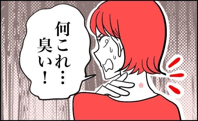 粉瘤 イメージカット