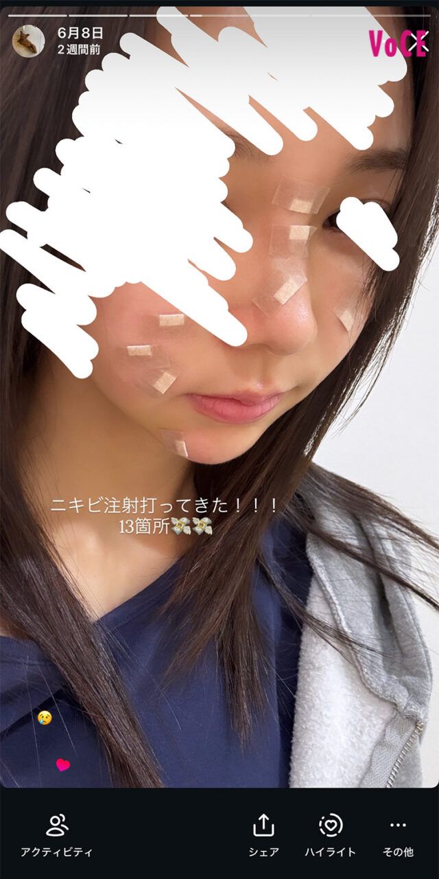 愛甲ひかりさん
