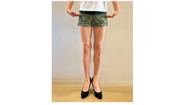 前からみた脚