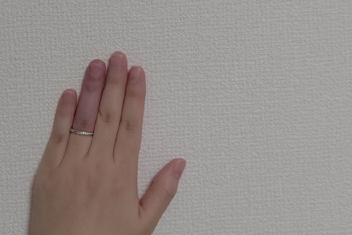 無理に引っ張るとさらに指が腫れてしまうため、まずは落ち着いて道具を準備しましょう