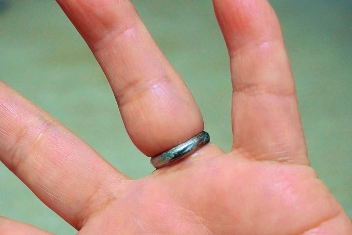 毎日身に着けている指輪が突然抜けなくなってしまったら…
