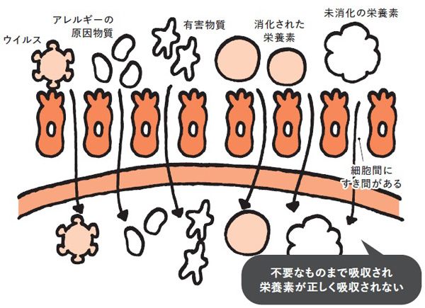 ■腸漏れを起こした腸粘膜