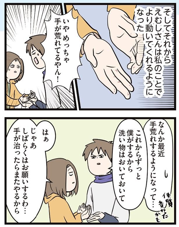 手が荒れてるやん！ （C）えむふじん／KADOKAWA
