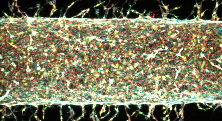 MITが磁石を使って人工血管を培養することに成功