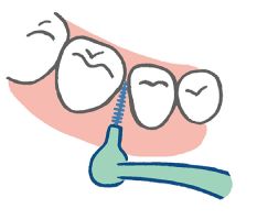 歯間ブラシの動かし方