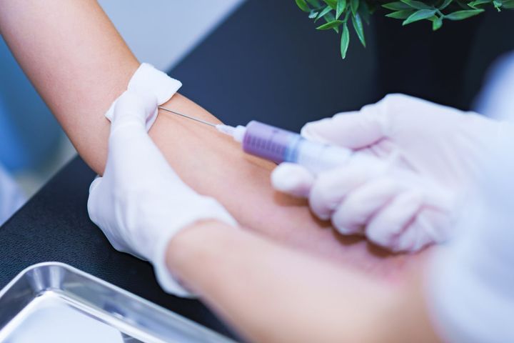 夏は糖尿病の指標である「HbA1c（ヘモグロビン・エー・ワン・シー）」が下がりやすい？（画像はイメージ）