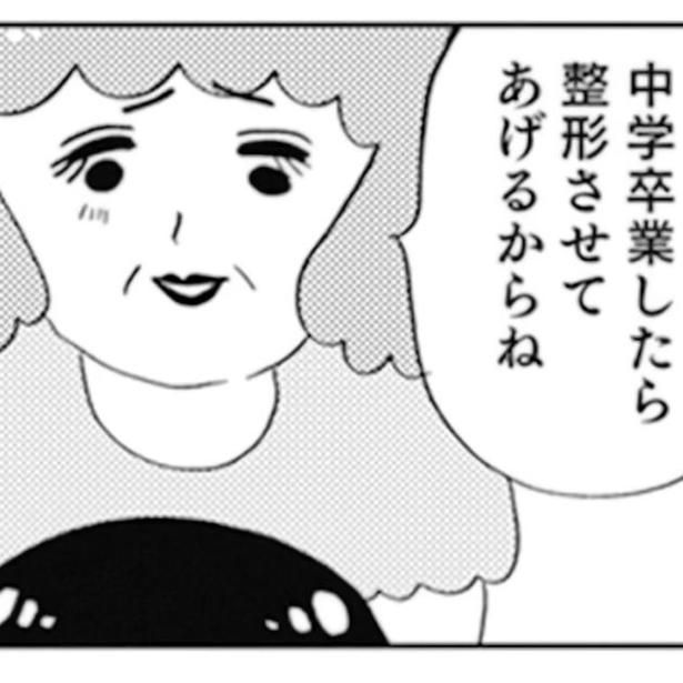 一重まぶたの娘を「かわいそうに」と憐れむ母。 (C)グラハム子／KADOKAWA