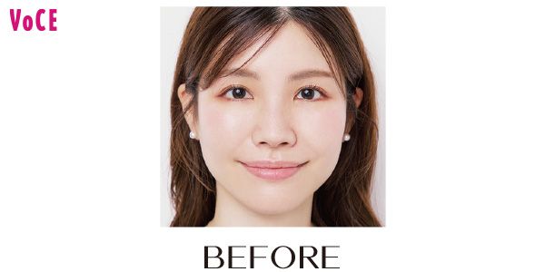mariさん BEFORE
