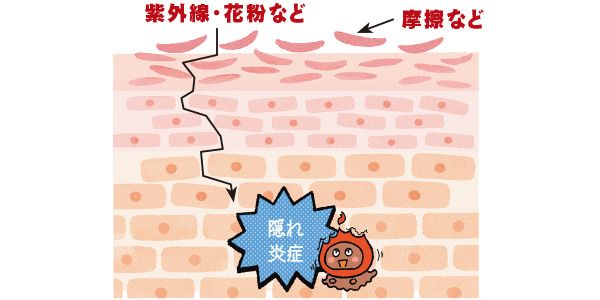 紫外線・花粉など→摩擦など→隠れ炎症