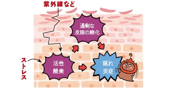 紫外線など ストレス 活性酸素→過剰な皮脂の酸化→隠れ炎症