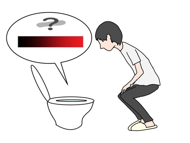 「いつもの便秘」が病気のサインに！？医師が教える、見逃してはいけない便通の変化と受診目安【医師コラム】