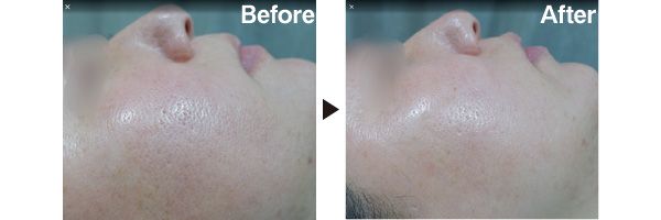 Before After