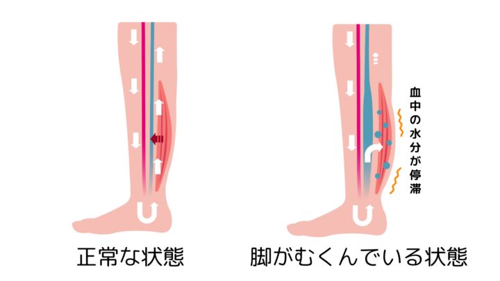 部位別ガイド】むくみ解消マッサージ大全｜顔・脚・全身をスッキリさせる方法 | 健康 ×スポーツ『MELOS』