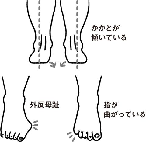 【健やかな足はこうなっている！】「疲れた！ 抱っこ！」は靴のせい？ 子どもの足を育てる「足育」を今日からさっそく始めましょう！の画像3