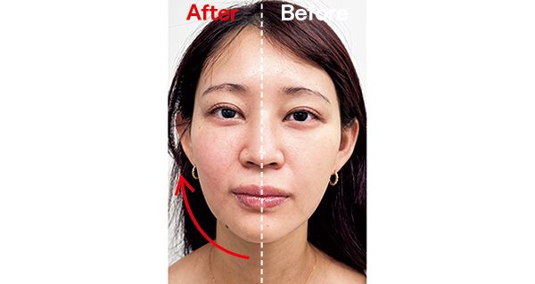 岩間美幸先生施術症例 Before After 