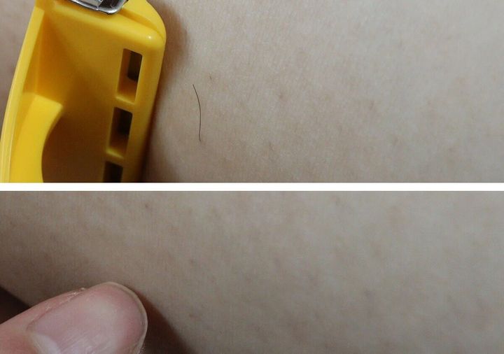 黄色いカミソリで腕の毛を剃る前と剃った後の肌を比較している