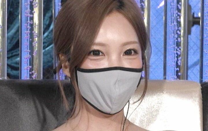 【写真・画像】「浮気や容姿否定が原因で…」28歳美容クリニック社員、整形を繰り返した理由を告白「総額1000万円いかないくらい…」 1枚目