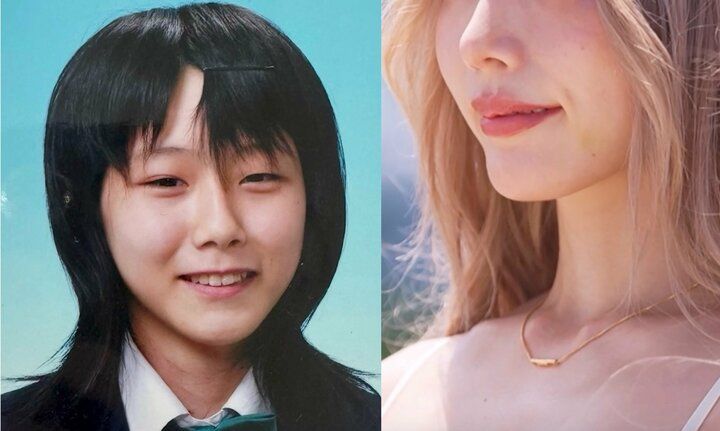 【写真・画像】「学生時代に見た目が原因でいじめに」33歳・金髪美女の元経営者、500万円の整形を告白 1枚目