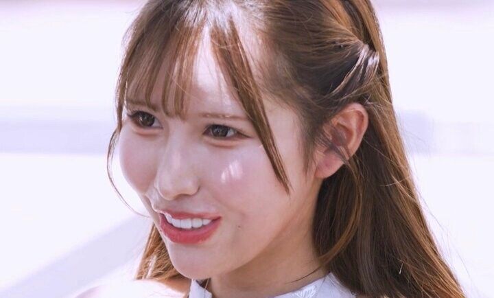 【写真・画像】「レスになったので…」高1で初整形した美女（28）、シリコン豊胸を告白 整形総額は「1000万円いかないくらい」 1枚目