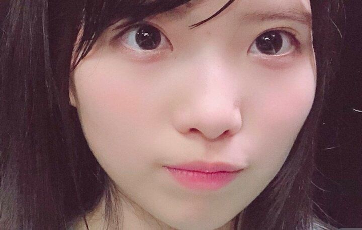 【写真・画像】「中1で初整形」元国民的アイドル（24）、600万円もの整形を告白「そうなんや！？」ビフォーアフターに驚きの声 1枚目