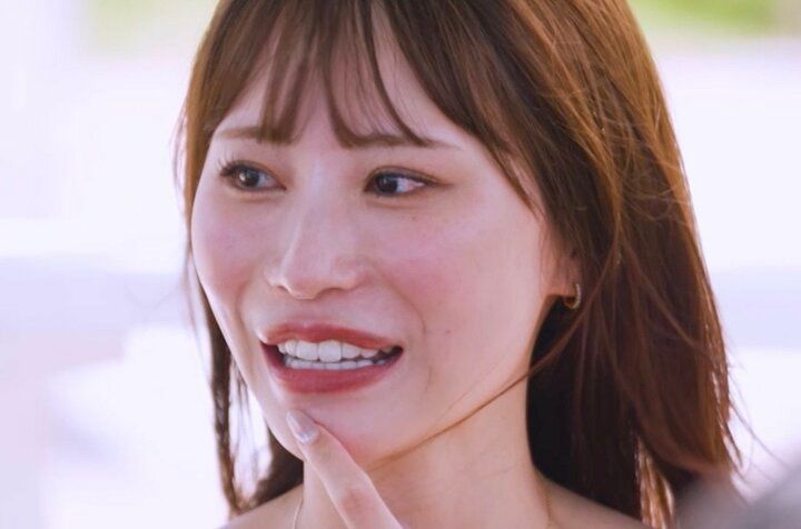 【写真・画像】「整形してる？」35歳グラドルが本音で回答「結構一生懸命やっております」施術中の写真も公開 1枚目