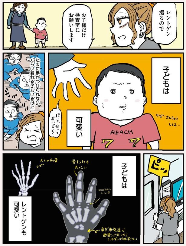 子どもはレントゲンも可愛い (C)からばく社／KADOKAWA